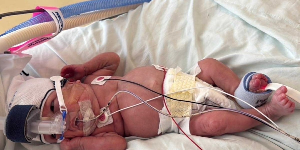 ‘A real life miracle’: Wisconsin baby born at 12.5 ounces graduates NICU after 375 days in hospital