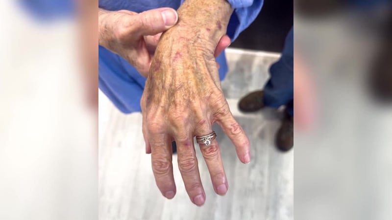 Plumbers found a wedding ring representing more than 50 years of marriage after it had been...